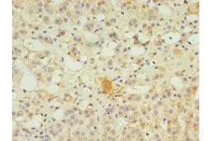 Immunohistochemistry of paraffin-embedded human adrenal gland tissue using ABIN7169349 at dilution of 1:100 (SERPINB8 Antikörper  (AA 60-242))