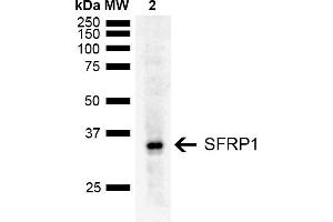 Western blot analysis of Rat Liver showing detection of ~35 kDa SFRP1 protein using Rabbit Anti-SFRP1 Polyclonal Antibody (ABIN5667734). (SFRP1 Antikörper  (AA 1-100) (FITC))