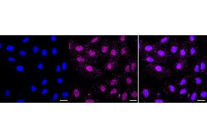 anti-E3 ubiquitin-protein ligase RAD18 (RAD18) antibody