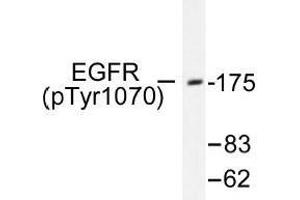 Image no. 1 for anti-Epidermal Growth Factor Receptor (EGFR) (pSer1070) antibody (ABIN318325) (EGFR Antikörper  (pSer1070))