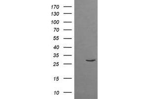 Image no. 1 for anti-Tripartite Motif Containing 38 (TRIM38) (AA 1-265) antibody (ABIN1490688) (TRIM38 Antikörper  (AA 1-265))
