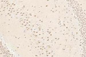 Immunohistochemistry (Paraffin-embedded Sections) (IHC (p)) image for anti-T-Box 19 (TBX19) antibody (ABIN7075815)