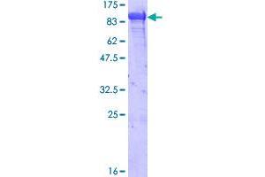 Image no. 1 for Heat Shock 70kDa Protein 5 (Glucose-Regulated Protein, 78kDa) (HSPA5) (AA 19-654) protein (GST tag) (ABIN1307202) (GRP78 Protein (AA 19-654) (GST tag))