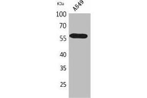 Western Blot analysis of A549 cells using ALDH2 Polyclonal Antibody. (ALDH2 Antikörper  (N-Term))