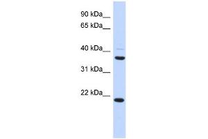 WB Suggested Anti-TMEM74 Antibody Titration: 0. (TMEM74 Antikörper  (Middle Region))