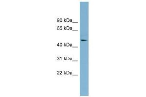 TMLHE antibody used at 1 ug/ml to detect target protein. (TMLHE Antikörper  (Middle Region))