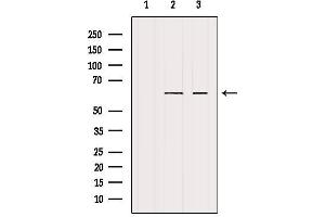 Western blot analysis of extracts from various samples, using Cytochrome P450 4F22 Antibody.