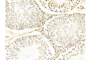 ABIN6258847 and ABIN6275709 at 1/100 staining Rat testis tissue by IHC-P. (RAD23B Antikörper  (N-Term))