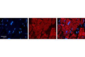 Rabbit Anti-CPT2 Antibody   Formalin Fixed Paraffin Embedded Tissue: Human heart Tissue Observed Staining: Cytoplasmic in mitochondria Primary Antibody Concentration: 1:100 Other Working Concentrations: 1:600 Secondary Antibody: Donkey anti-Rabbit-Cy3 Secondary Antibody Concentration: 1:200 Magnification: 20X Exposure Time: 0. (CPT2 Antikörper  (N-Term))