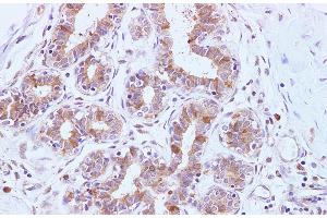 Immunohistochemistry (Paraffin-embedded Sections) (IHC (p)) image for anti-Breast Cancer 2, Early Onset (BRCA2) antibody (ABIN7234156)