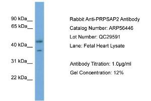 WB Suggested Anti-PRPSAP2  Antibody Titration: 0. (PRPSAP2 Antikörper  (Middle Region))