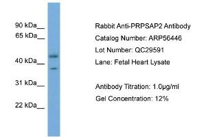 WB Suggested Anti-PRPSAP2  Antibody Titration: 0. (PRPSAP2 Antikörper  (Middle Region))