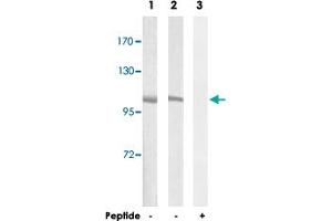 Western blot analysis of extracts from A-549 cells (Lane 1 and lane 3) and NIH/3T3 cells (Lane 2), using CNGB1 polyclonal antibody . (GARP Antikörper)