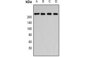 Western blot analysis of SMCHD1 expression in SKOV3 (A), Jurkat (B), HepG2 (C), rat brain (D) whole cell lysates.