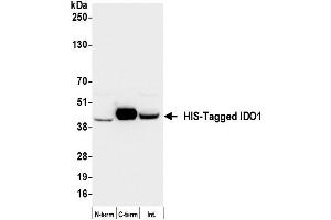 Western Blotting (WB) image for anti-His Tag antibody (ABIN7795586) (Rekombinanter His Tag Antikörper)