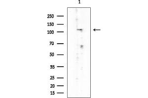 anti-Myosin Phosphatase, Target Subunit 1 (PPP1R12A) (Internal Region) antibody