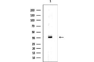 Western blot analysis of lysates from EC304 cells, using OVOL1 Mouse Monoclonal Antibody at 1/1000 dilution.