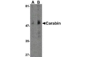 Western Blotting (WB) image for anti-TBC1 Domain Family, Member 10C (TBC1D10C) (N-Term) antibody (ABIN2477883) (Carabin Antikörper  (N-Term))