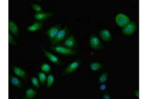 Immunofluorescent analysis of A549 cells using ABIN7148523 at dilution of 1:100 and Alexa Fluor 488-congugated AffiniPure Goat Anti-Rabbit IgG(H+L) (Copine IV Antikörper  (AA 1-280))