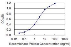 Detection limit for recombinant GST tagged FTCD is 0. (FTCD Antikörper  (AA 440-541))