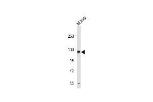 Anti-M Sema5a Antibody (N-term) at 1:1000 dilution + Mouse liver tissue lysate Lysates/proteins at 20 μg per lane. (SEMA5A Antikörper  (N-Term))