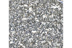 IHC analysis of HOXD11 using anti-HOXD11 antibody (ABIN7603174). (HOXD11 Antikörper  (N-Term))