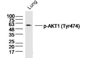 Mouse lung lysates probed with AKT1/2/3 (Tyr474) Polyclonal Antibody, unconjugated  at 1:300 overnight at 4°C followed by a conjugated secondary antibody at 1:10000 for 90 minutes at 37°C. (AKT 1/2/3 Antikörper  (pTyr474))