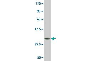 Western Blotting (WB) image for anti-Homeobox D1 (HOXD1) (AA 151-240) antibody (ABIN516664)
