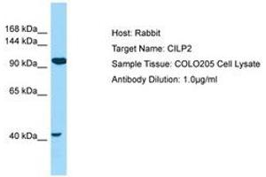 Image no. 1 for anti-Cartilage Intermediate Layer Protein 2 (Cilp2) (AA 112-161) antibody (ABIN6750043) (Cilp2 Antikörper  (AA 112-161))