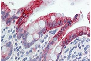 Immunohistochemistry (Formalin-fixed Paraffin-embedded Sections) (IHC (fp)) image for anti-Keratin 20 (KRT20) antibody (FITC) (ABIN790403)