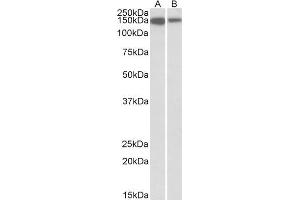 ABIN1590041 (1 µg/mL) staining of Jurkat (A) and Human Thymus (B) lysates (35 µg protein in RIPA buffer). (MCF2L Antikörper  (Internal Region))