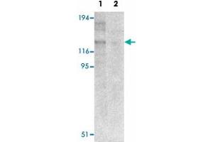 Western blot analysis of NLRP8 in human colon tissue lysate with NLRP8 polyclonal antibody  at 1 ug/mL in (1) the absence and (2) the presence of blocking peptide. (NALP8 Antikörper  (N-Term))