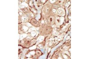 Image no. 2 for anti-Platelet Derived Growth Factor Receptor beta (PDGFRB) (N-Term) antibody (ABIN359919) (PDGFRB Antikörper  (N-Term))