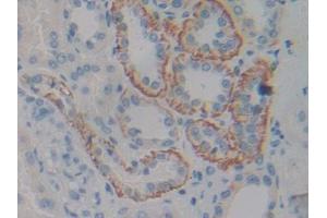 IHC-P analysis of Human Kidney Tissue, with DAB staining. (CNTF Receptor alpha Antikörper  (AA 120-358))