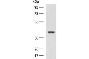 Western blot analysis of K562 and HepG2 cell lysates using RBM4 Polyclonal Antibody at dilution of 1:750 (RBM4 Antikörper)