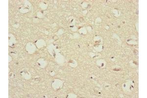 Immunohistochemistry of paraffin-embedded human brain tissue using ABIN7147433 at dilution of 1:100