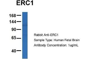 Host: Rabbit  Target Name: ERC1  Sample Tissue: Human Fetal Brain  Antibody Dilution: 1. (ERC1 Antikörper  (C-Term))