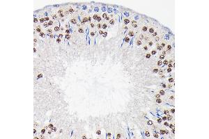Immunohistochemistry of paraffin-embedded rat testis using PI3 Kinase p85 beta Rabbit mAb (ABIN1679407, ABIN3019246, ABIN3019247 and ABIN7101736) at dilution of 1:100 (40x lens). (PIK3R2 Antikörper)