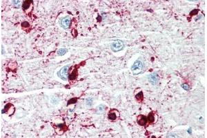 Human Brain, Cortex (formalin-fixed, paraffin-embedded) stained with CRYAB antibody ABIN462098 at 10 µg/ml followed by biotinylated goat anti-rabbit IgG secondary antibody ABIN481713, alkaline phosphatase-streptavidin and chromogen. (CRYAB Antikörper)