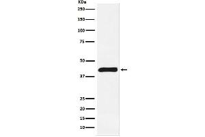 Western blot analysis of ALKBH1 expression in Jurkat cell lysate. (Rekombinanter ALKBH1 Antikörper)