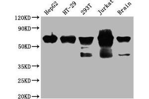 Western Blot Positive WB detected in: HepG2 whole cell lysate, HT-29 whole cell lysate, 293T whole cell lysate, Jurkat whole cell lysate, Mouse brain tissue All lanes: DDX5 antibody at 1:2000 Secondary Goat polyclonal to rabbit IgG at 1/50000 dilution Predicted band size: 70, 61 kDa Observed band size: 70 kDa (Rekombinanter DDX5 Antikörper)