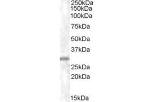 Western Blotting (WB) image for anti-Charged Multivesicular Body Protein 5 (CHMP5) (AA 202-215) antibody (ABIN296810)