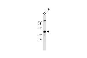 Anti-CCNY Antibody (Center) at 1:1000 dilution + Mouse heart lysate Lysates/proteins at 20 μg per lane. (Cyclin Y Antikörper  (AA 140-169))