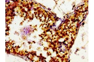 Immunohistochemistry of paraffin-embedded human testis tissue using ABIN7160161 at dilution of 1:100 (SLC16A12 Antikörper  (AA 431-486))