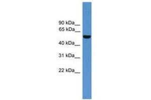 Image no. 1 for anti-Aldehyde Dehydrogenase 9 Family, Member A1 (ALDH9A1) (AA 351-400) antibody (ABIN6746619) (ALDH9A1 Antikörper  (AA 351-400))