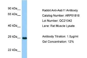Western Blotting (WB) image for anti-Ankyrin Repeat and SOCS Box-Containing 11 (ASB11) (N-Term) antibody (ABIN970148) (ASB11 Antikörper  (N-Term))