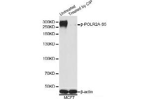 Western blot analysis of extracts of MCF7 cells using Phospho-POLR2A(S5) Polyclonal Antibody at dilution of 1:1000. (POLR2A/RPB1 Antikörper  (pSer5))
