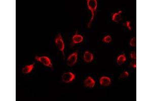 ABIN6266753 staining HeLa by IF/ICC. (MUTYH Antikörper  (Internal Region))