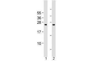 Western blot testing of human 1) cerebellum and 2) spleen tissue lysate with Grancalcin antibody at 1:2000. (Grancalcin Antikörper  (AA 19-53))