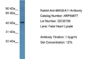 WB Suggested Anti-MAGEA11  Antibody Titration: 0. (MAGEA11 Antikörper  (Middle Region))